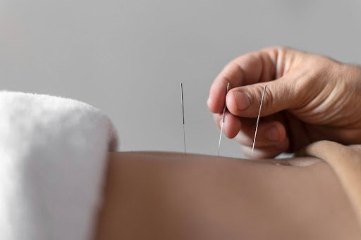 acupuncture for fertility in miami